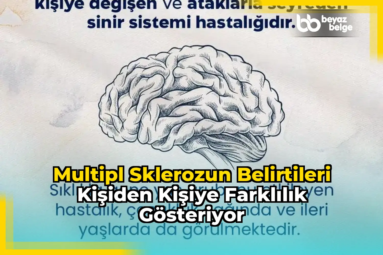 Multipl sklerozun belirtileri kişiden kişiye farklılık gösteriyor
